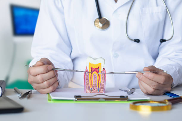 Best Knocked-Out Tooth (Avulsed Tooth) Treatment in Marlton, MD